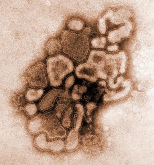 virus_h1n1